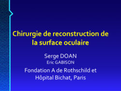 2019 : Reconstruction des surfaces oculaires – Dr Serge DOAN